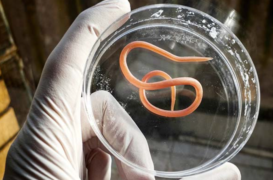 До чого сняться глисти: повне тлумачення снів про паразитів